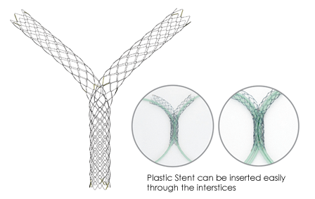 Biliary LCD Stent