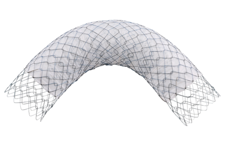 Niti-S Pyloric/duodenal Comvi™ (Triple Layer,Partially covered) Stent