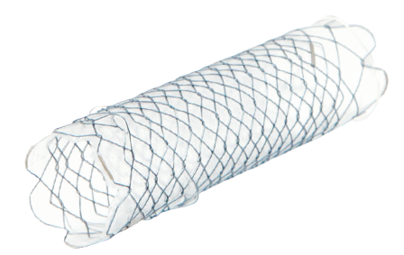Niti-S Biliary Interventional Uretheral Stent
